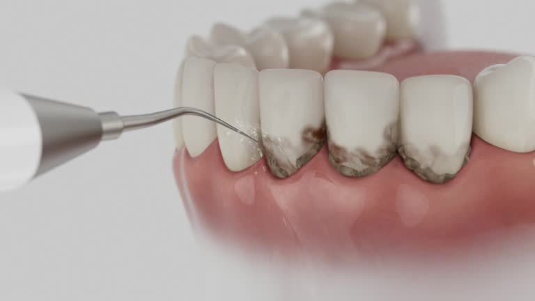 Reliable Dental contractor in Lauderdale Lakes, WI by Dentist Open Now